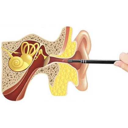 Endoskop za čiščenje ušes CLEANHEAR
