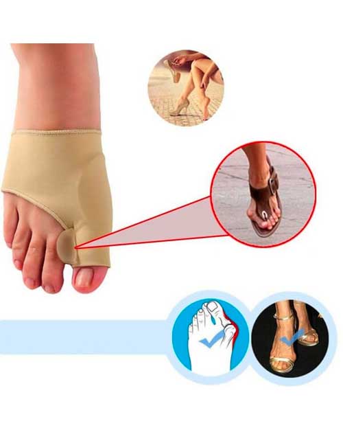 FIXEDFEET 1 pár (bal + jobb) ortopédiai lábujj-korrigáló
