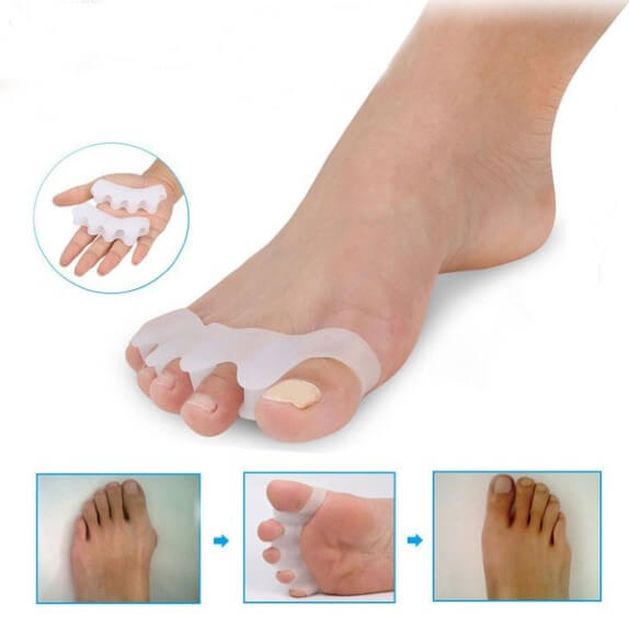 HALLUX SZILIKON LÁBUJJ TÁVTARTÓ