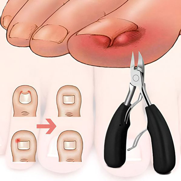 Profesionální sada na úpravu nehtů NAILPRO